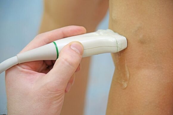 Ultrazvuk vena