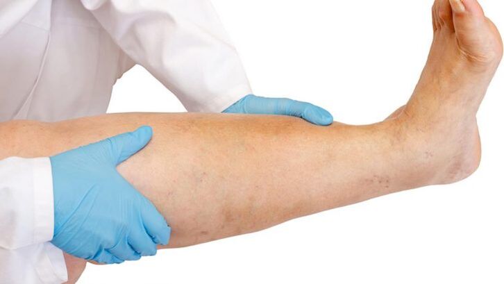 kako prepoznati bolest